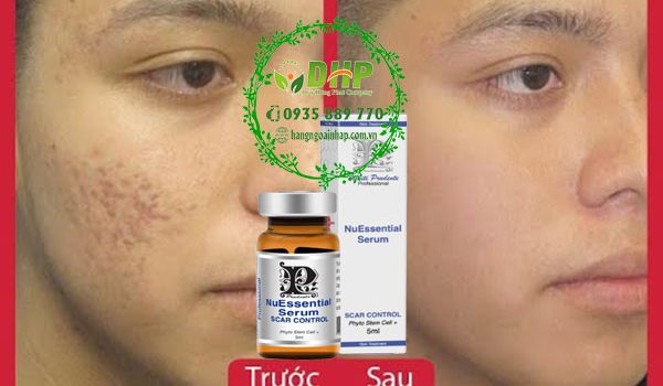 te-bao-goc-tri-seo-ro-seo-lom-nuessential-serum-scar-control6